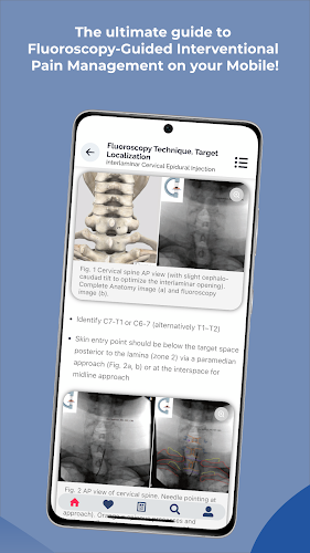 Interventional Pain App Ekran Görüntüsü 3