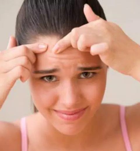 guide to Get rid of Acne Ekran Görüntüsü 0