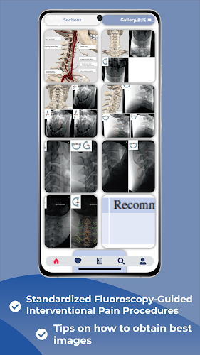 Schermata Interventional Pain App 2